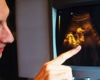 avances cadiopatias congenitas