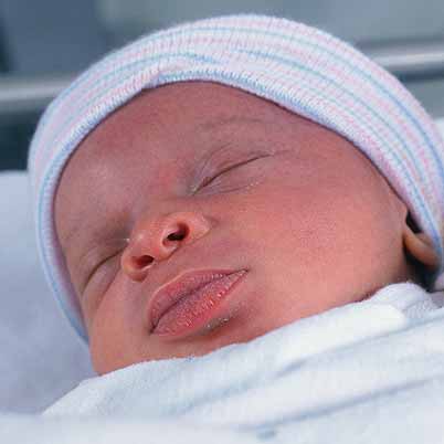 Bebe Meningitis