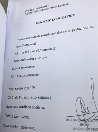 luciana informe ecografico