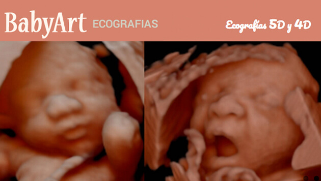 BabyArt ecografias 5D