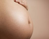 parto natural después de una cesárea